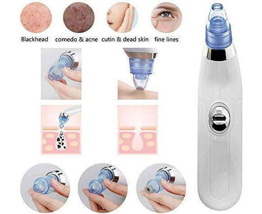 Blackhead Remover | Vacuum Pore Cleaner | 4-in-1 Suction Tool | Acne & Dead Skin Extractor